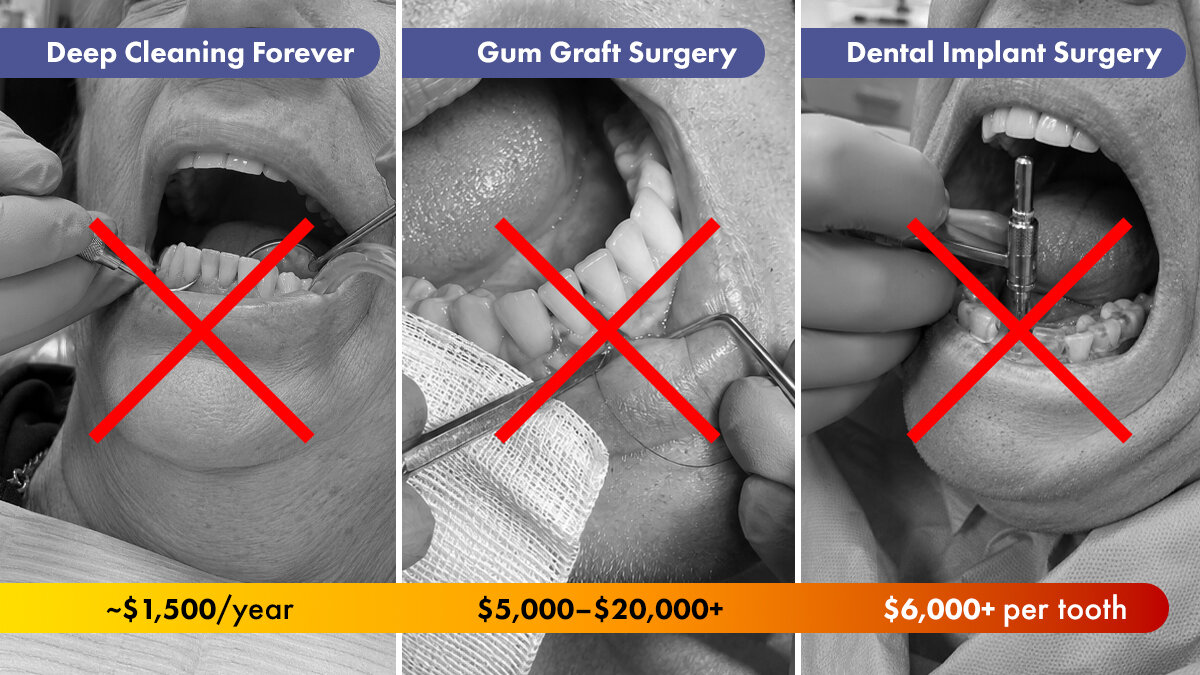 What Fixing Your Gums Really Costs in Australia